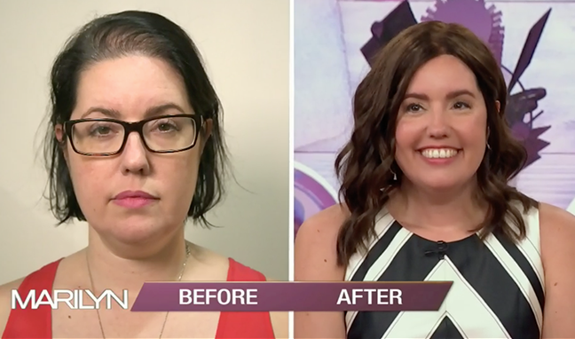 Marilyn Makeover: 3 Women Who Experience Hair Loss